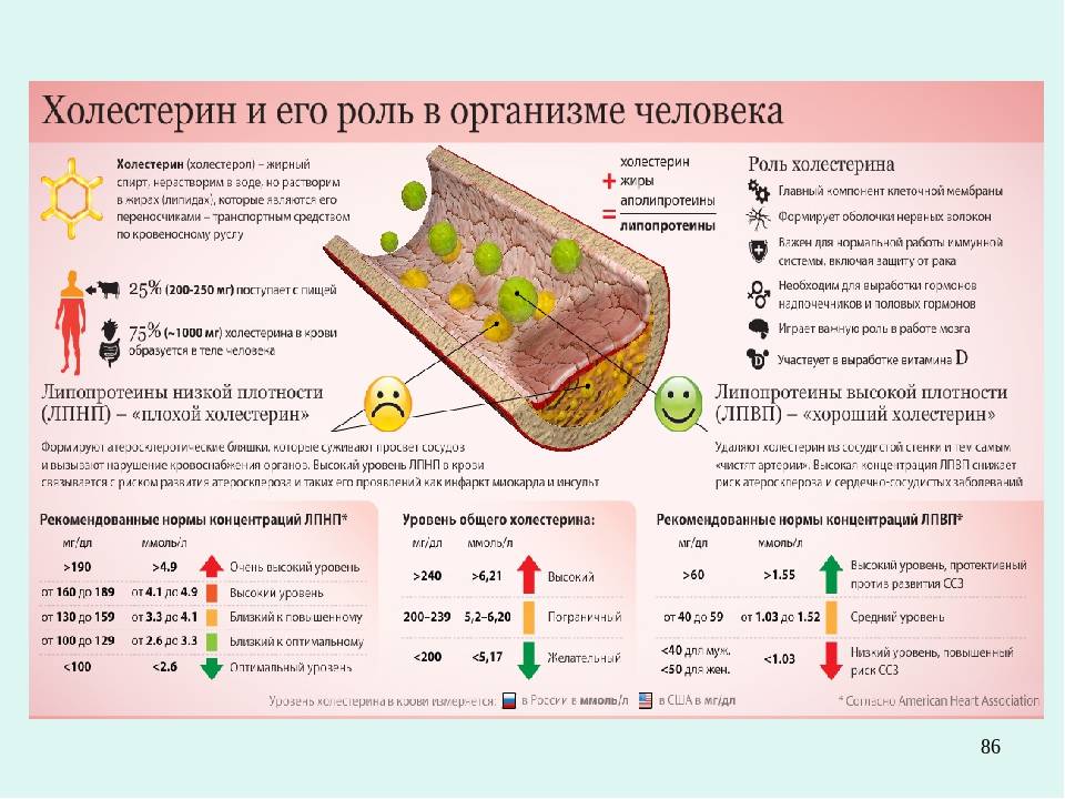 Замена фильтра салона – когда нужно делать и как сэкономить?